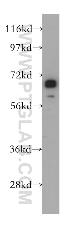 ZNF410 Polyclonal antibody