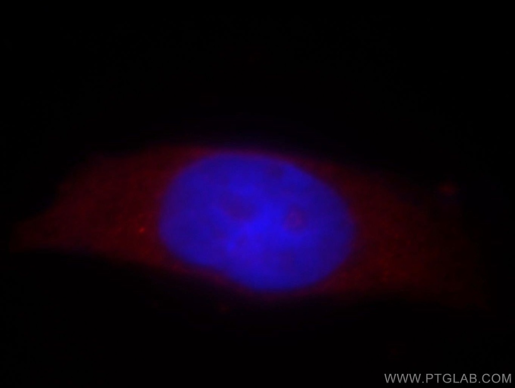 TSSC4 Polyclonal antibody