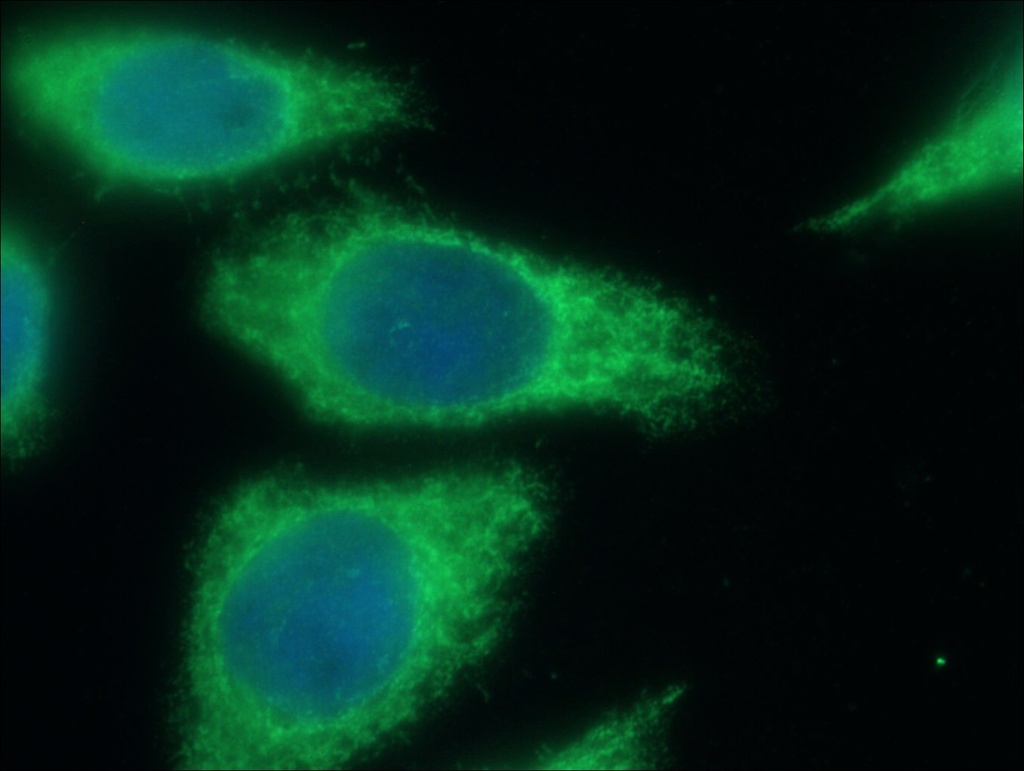 MT1-MMP Polyclonal antibody