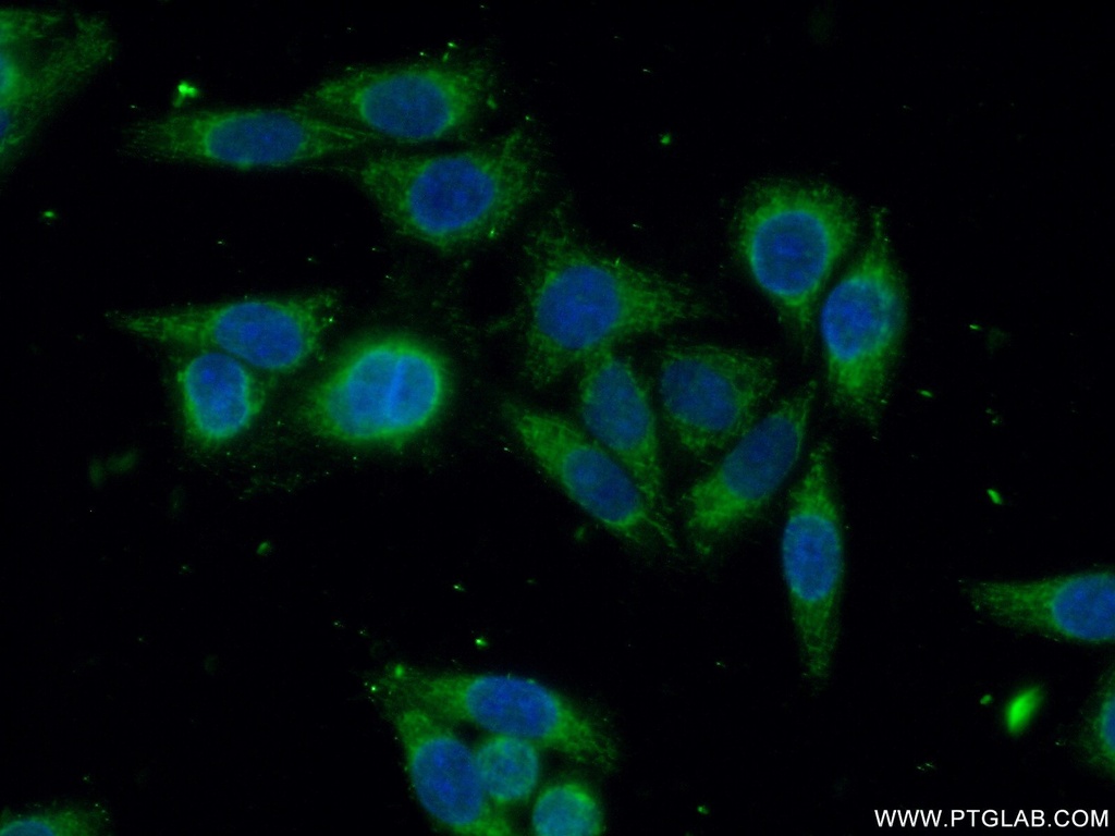GSTO2 Polyclonal antibody