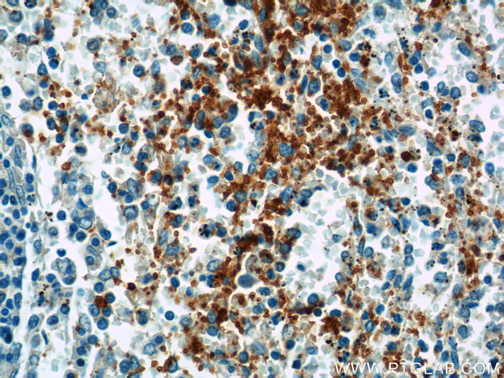 GP9 Polyclonal antibody