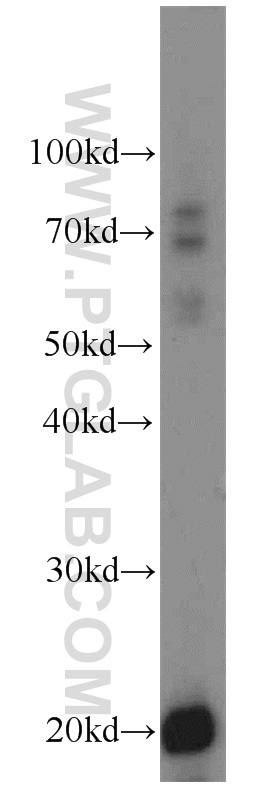 TMEM27 Polyclonal antibody