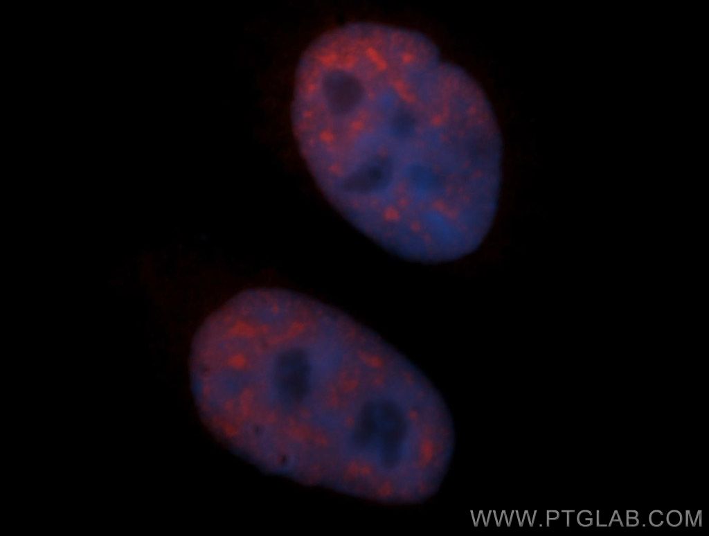 SF3B3 Polyclonal antibody