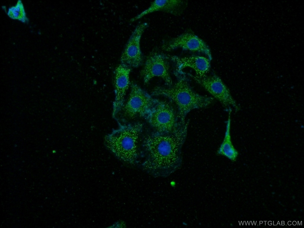Pikachurin Polyclonal antibody