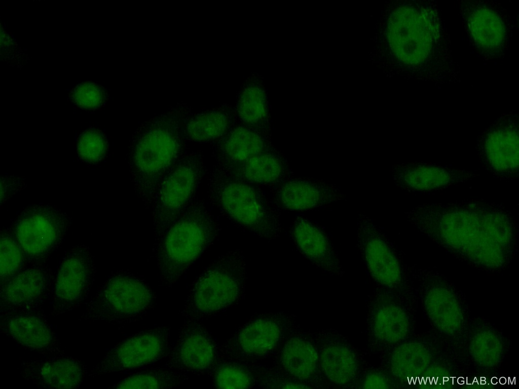 HMG20B Polyclonal antibody
