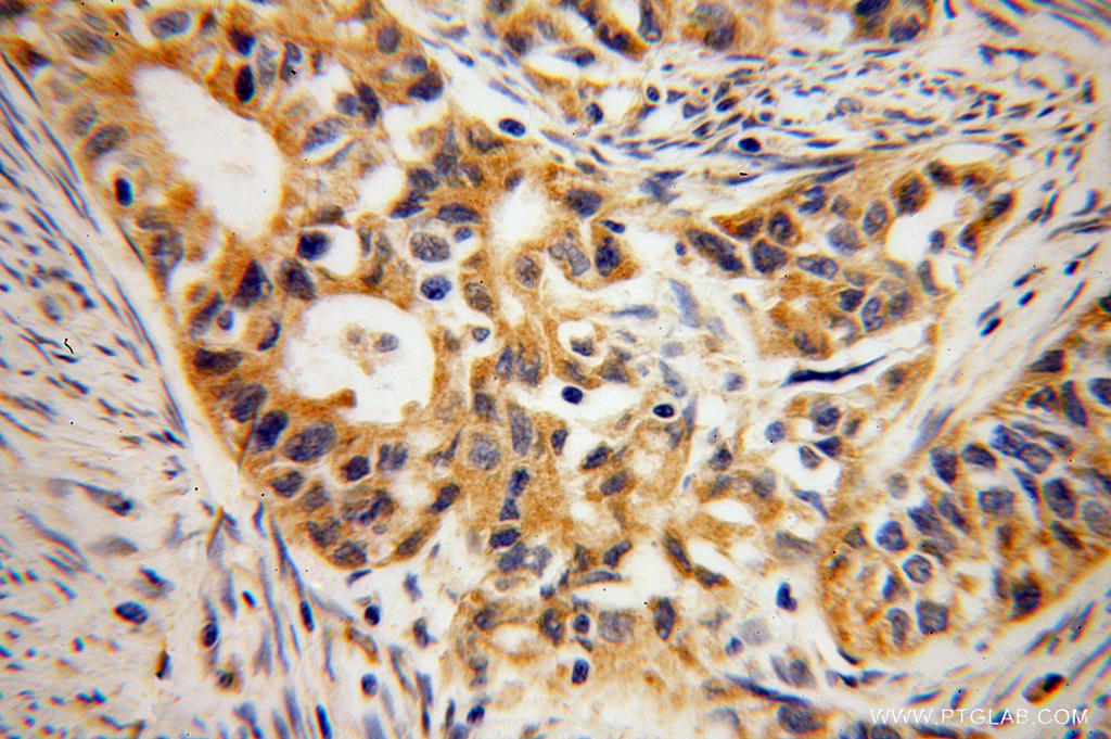 B3GALTL Polyclonal antibody