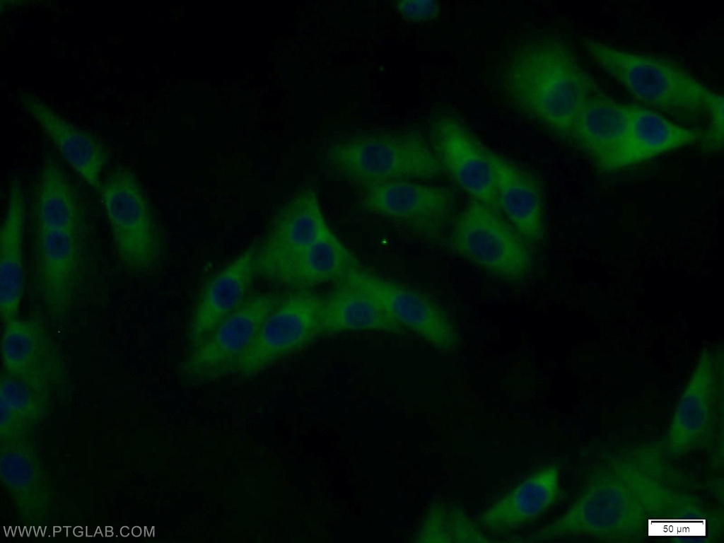 MAGEA6 Polyclonal antibody