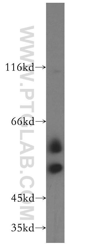 TCP11 Polyclonal antibody