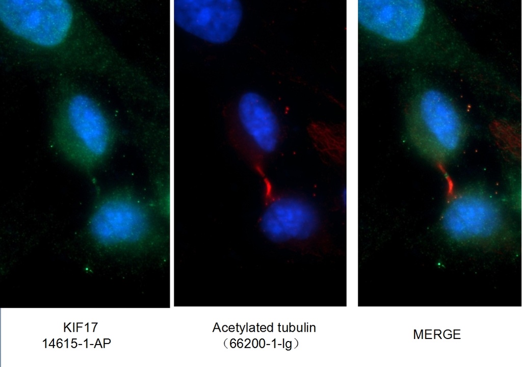KIF17 Polyclonal antibody