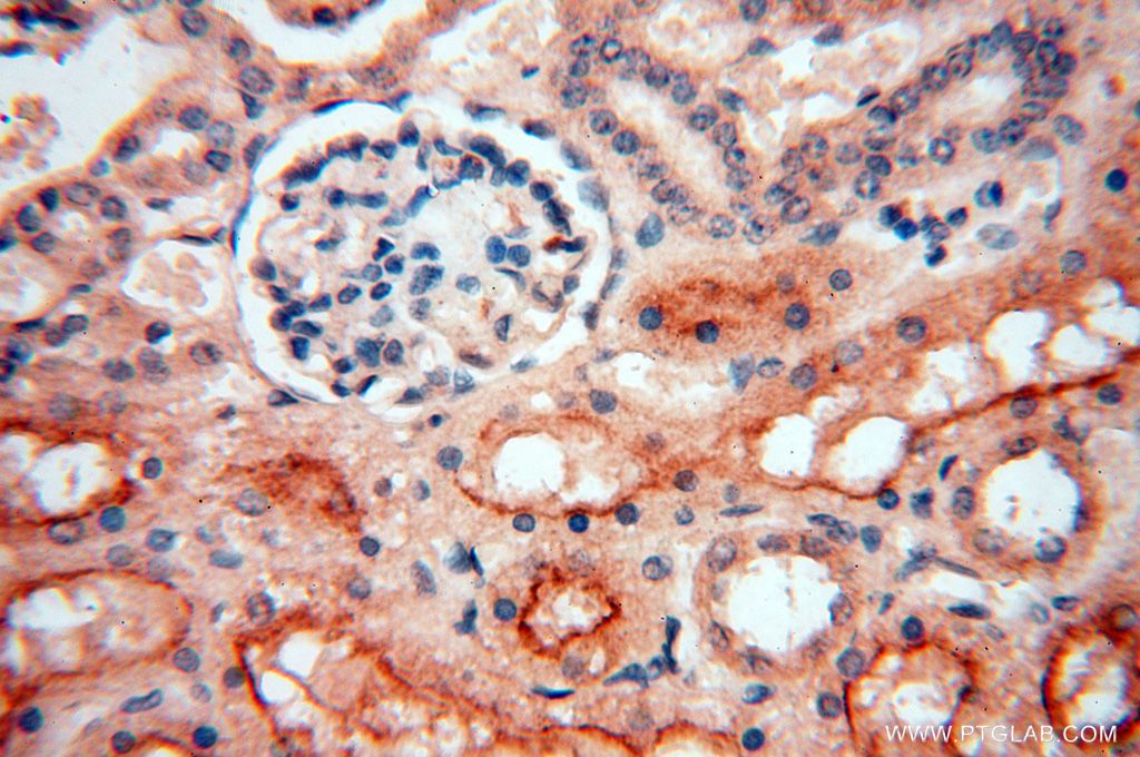 AKAP14 Polyclonal antibody