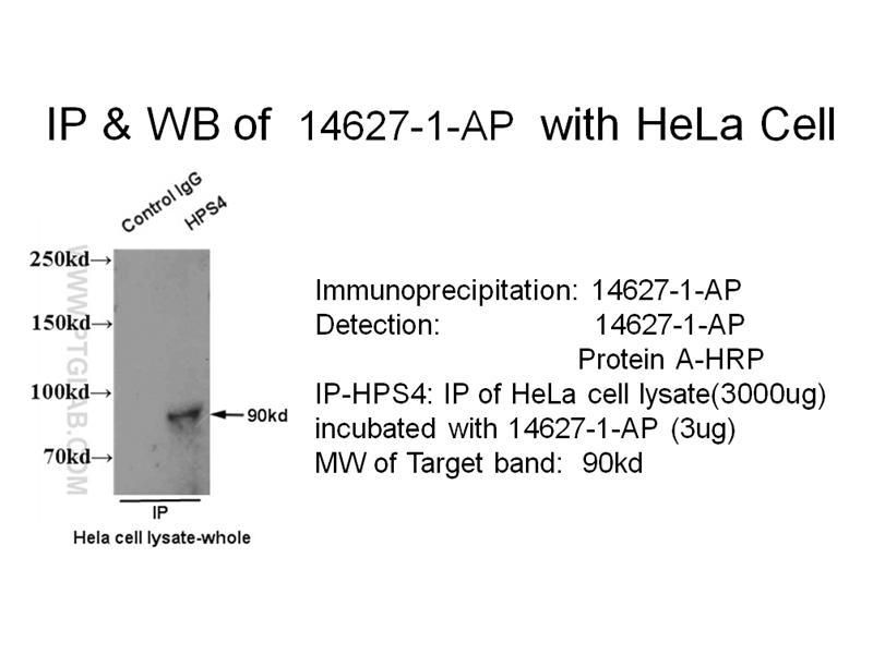 HPS4 Polyclonal antibody