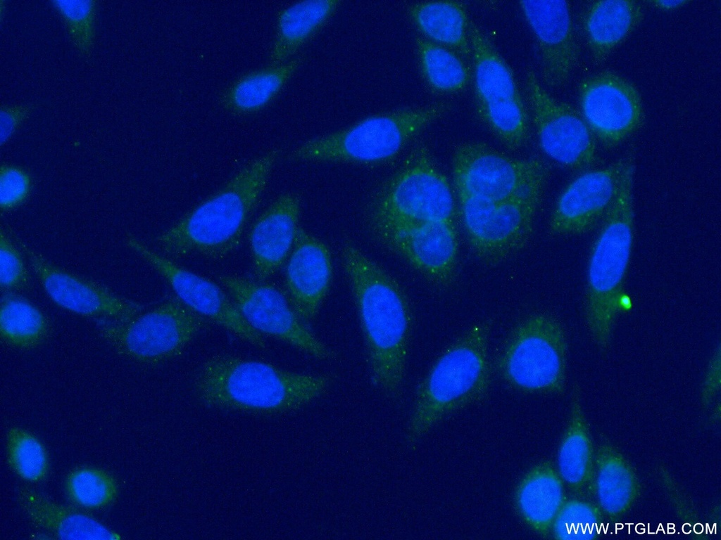 DDX6 Polyclonal antibody