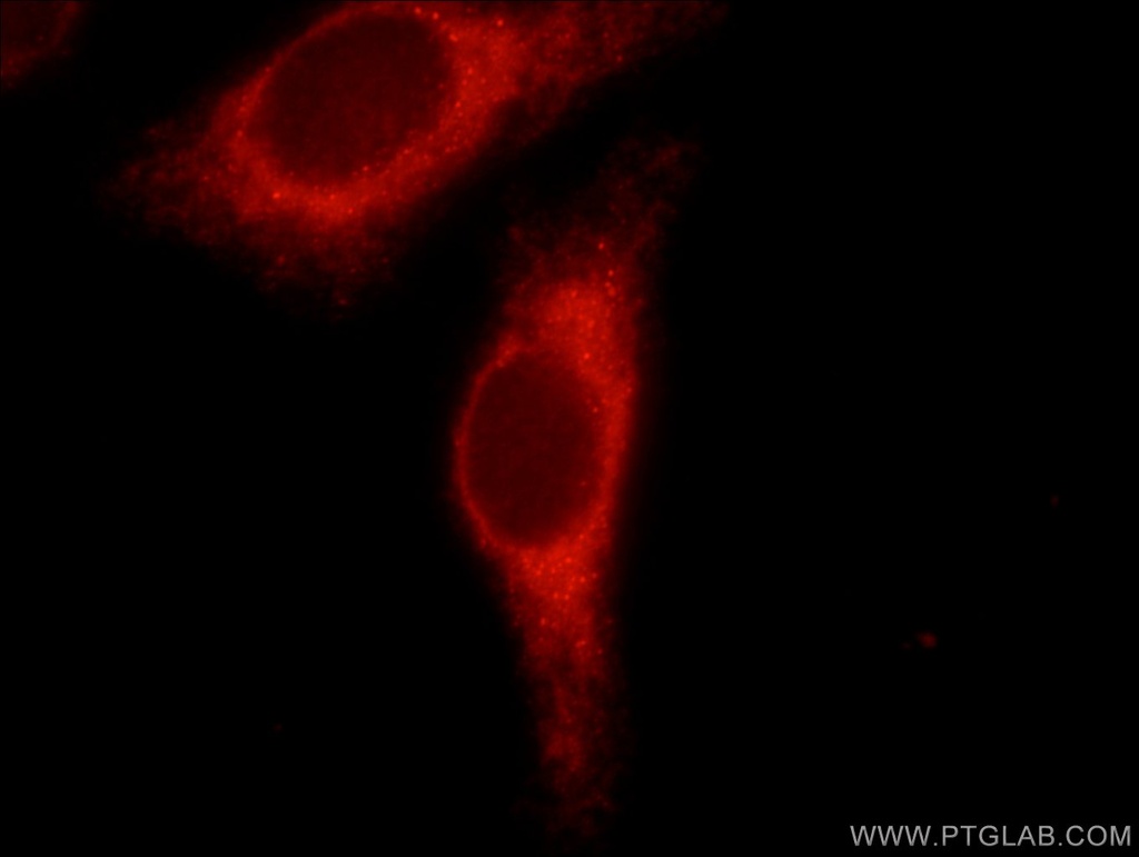 PPP1R15B Polyclonal antibody