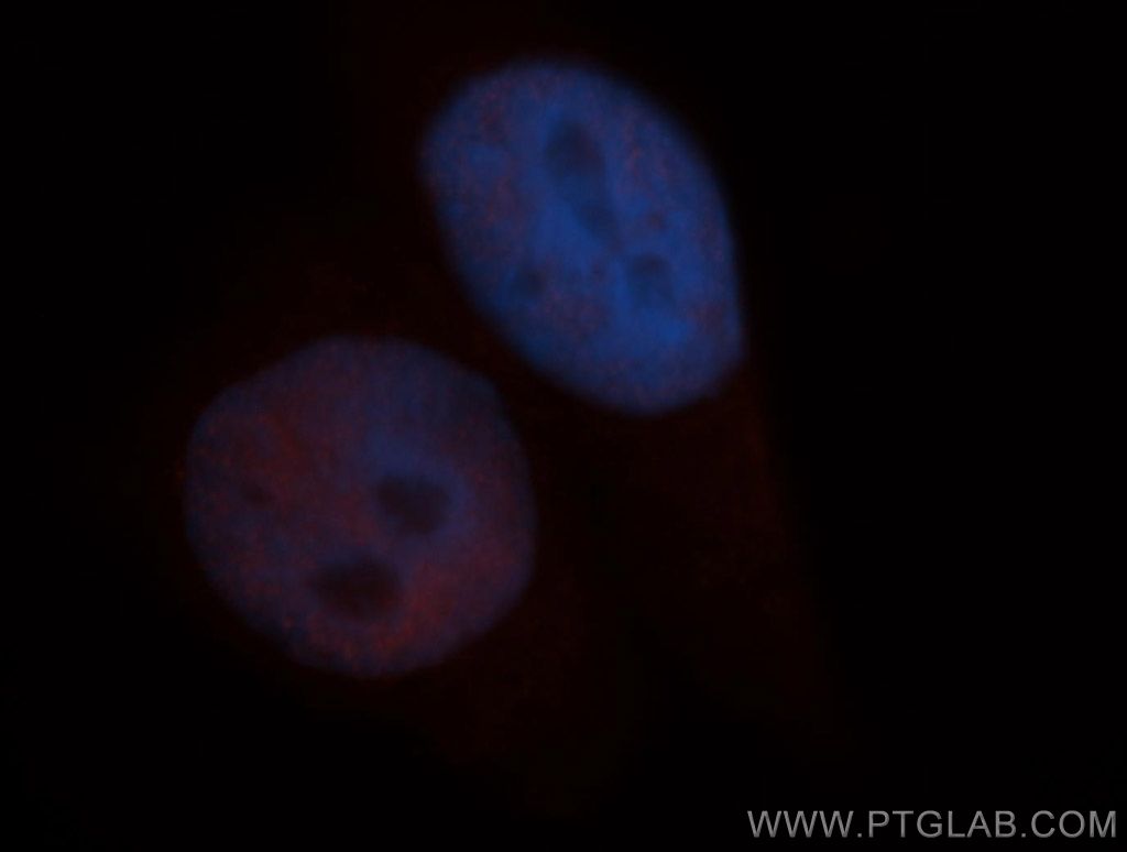 SIN3A Polyclonal antibody