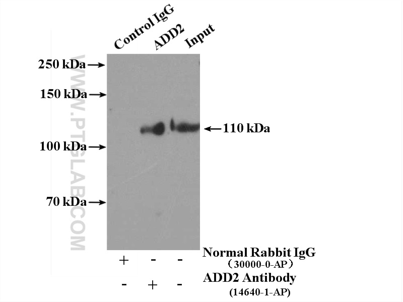 Beta Adducin Polyclonal antibody