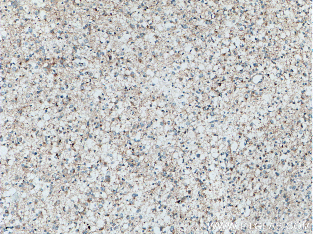 POSH Polyclonal antibody