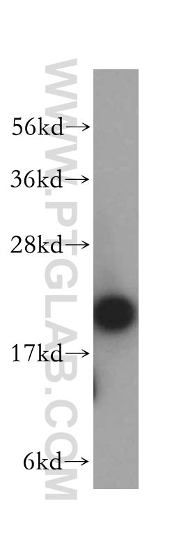 ARPC3 Polyclonal antibody