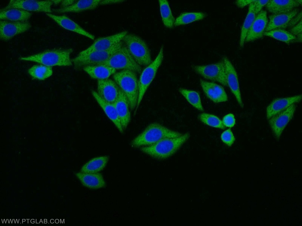 RPL18A Polyclonal antibody