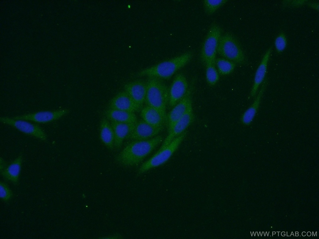 EIF1AX Polyclonal antibody
