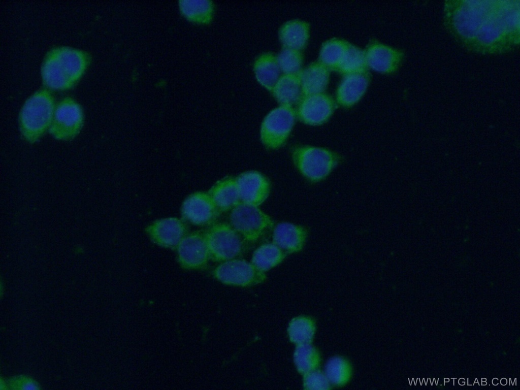 Decorin Polyclonal antibody