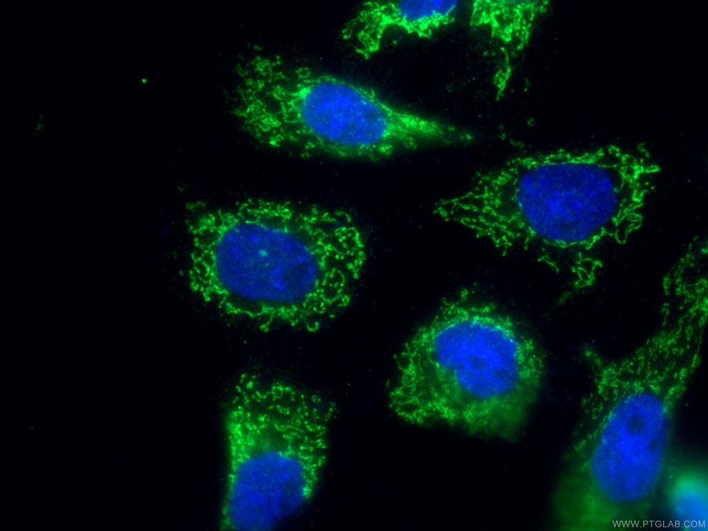 SLC25A24 Polyclonal antibody
