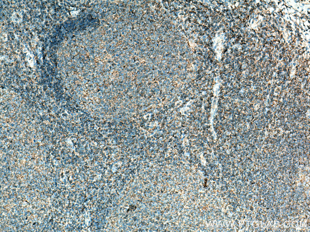 HLA-F Polyclonal antibody