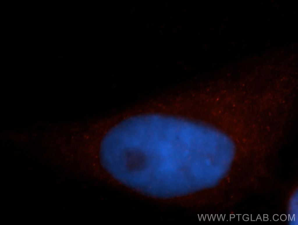 SEPT11 Polyclonal antibody