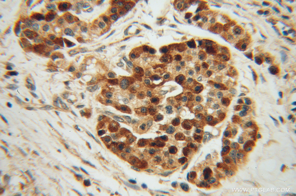 ZADH2 Polyclonal antibody