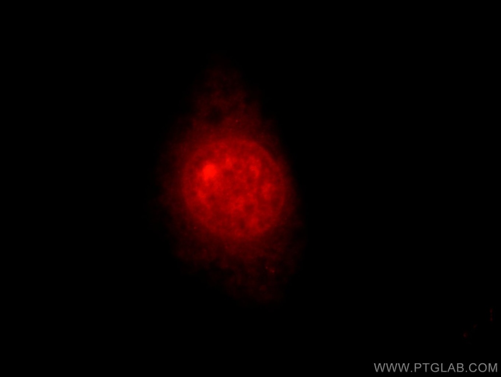 MTA3 Polyclonal antibody