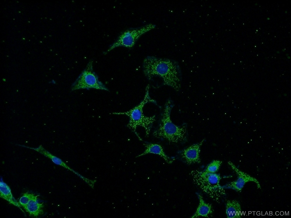 CRMP2 Polyclonal antibody