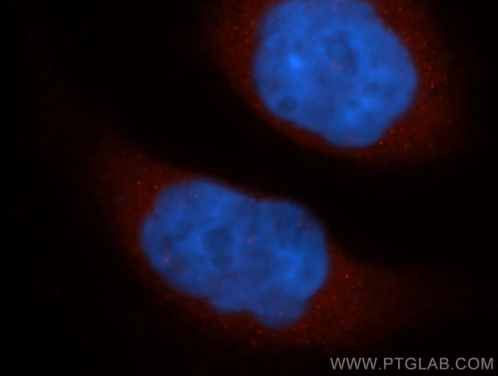 THEM4 Polyclonal antibody