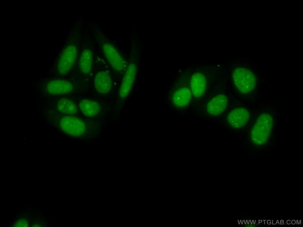 PAPSS1 Polyclonal antibody
