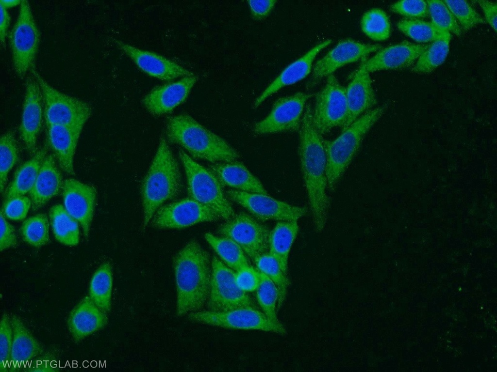 PGD Polyclonal antibody