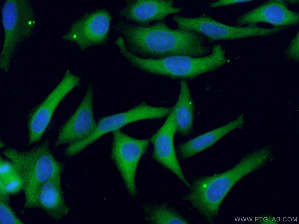 PHGDH Polyclonal antibody