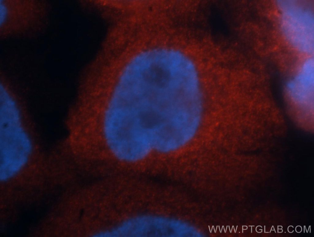 AHSA1 Polyclonal antibody