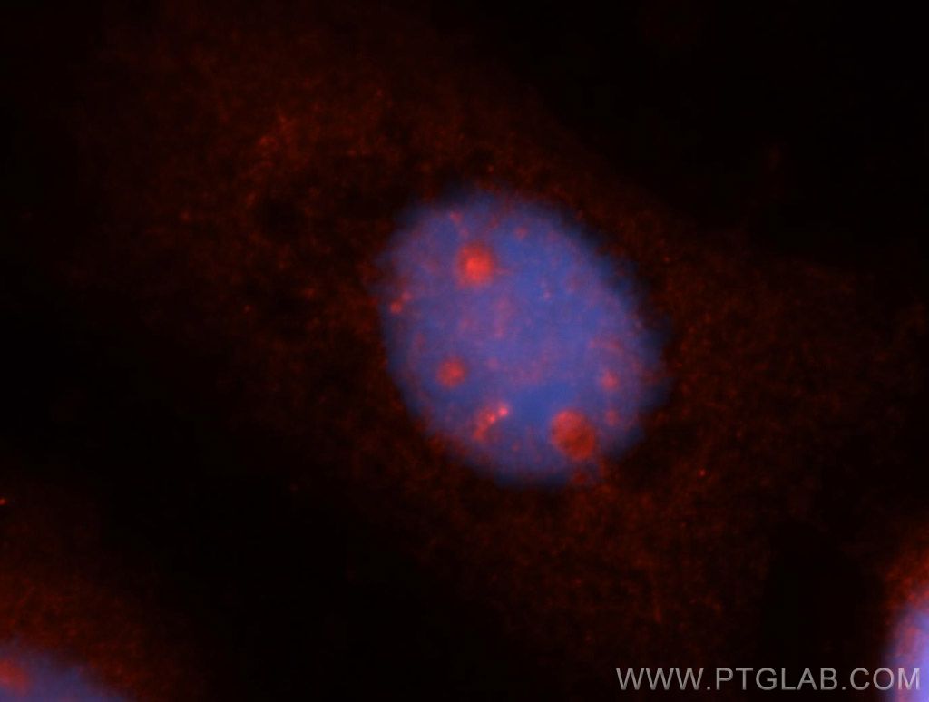 SPAG5 Polyclonal antibody
