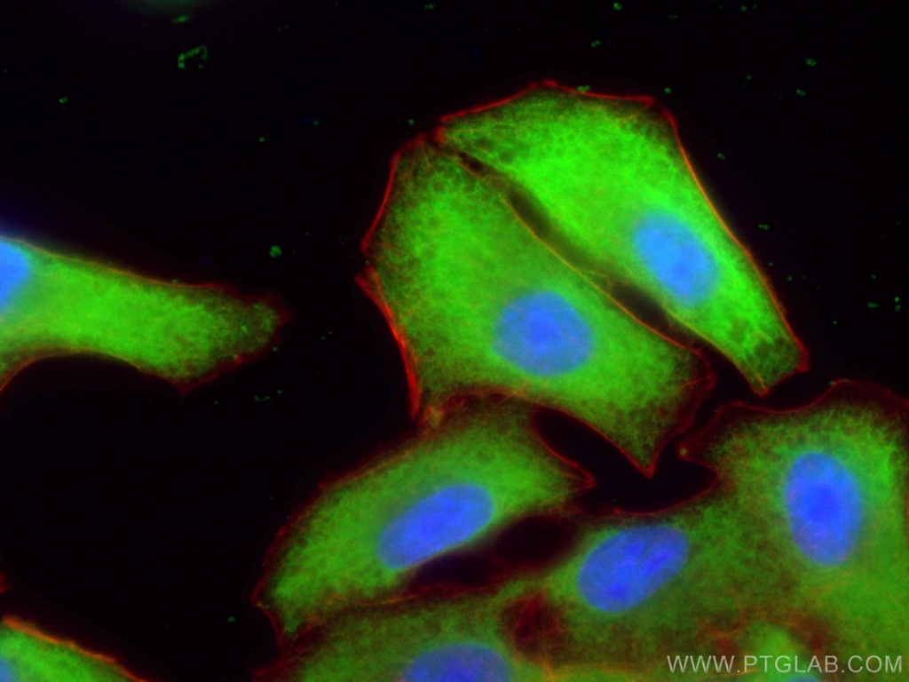 UCHL1/PGP9.5 Polyclonal antibody