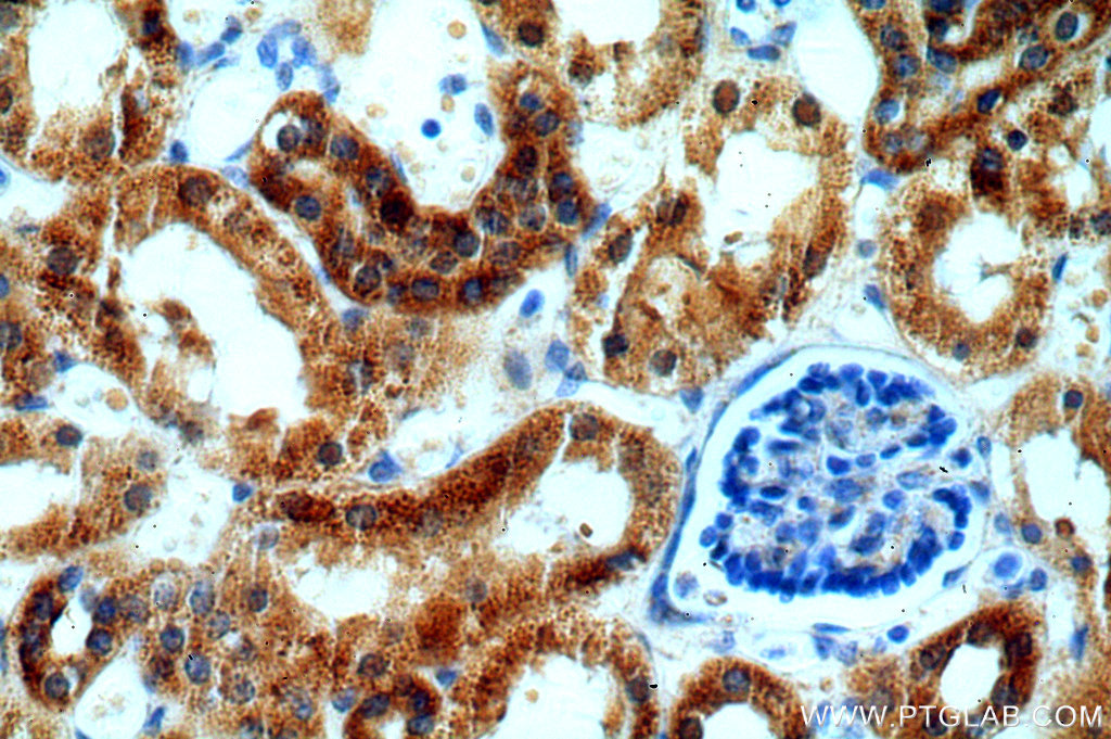IVNS1ABP Polyclonal antibody
