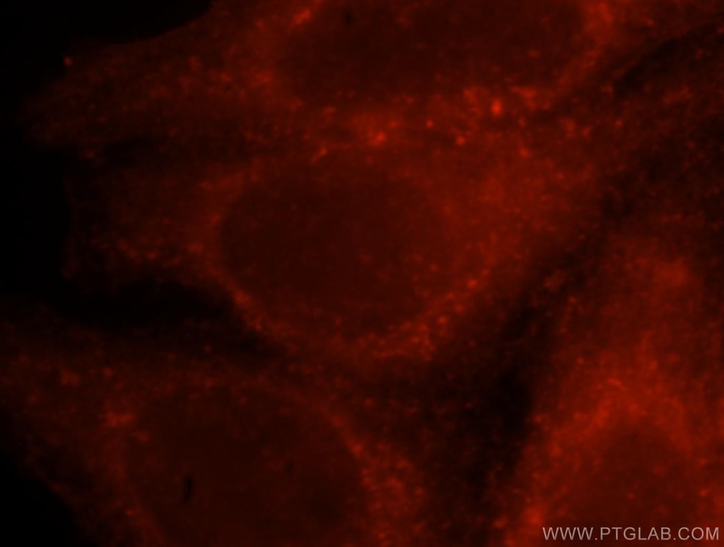 CORO1C Polyclonal antibody