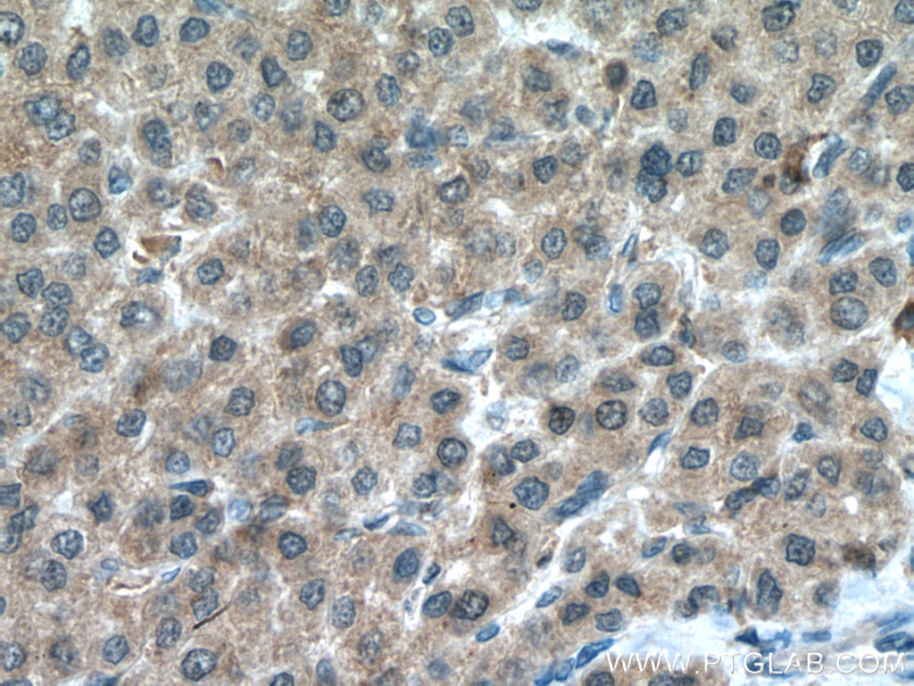 PSMC5 Polyclonal antibody