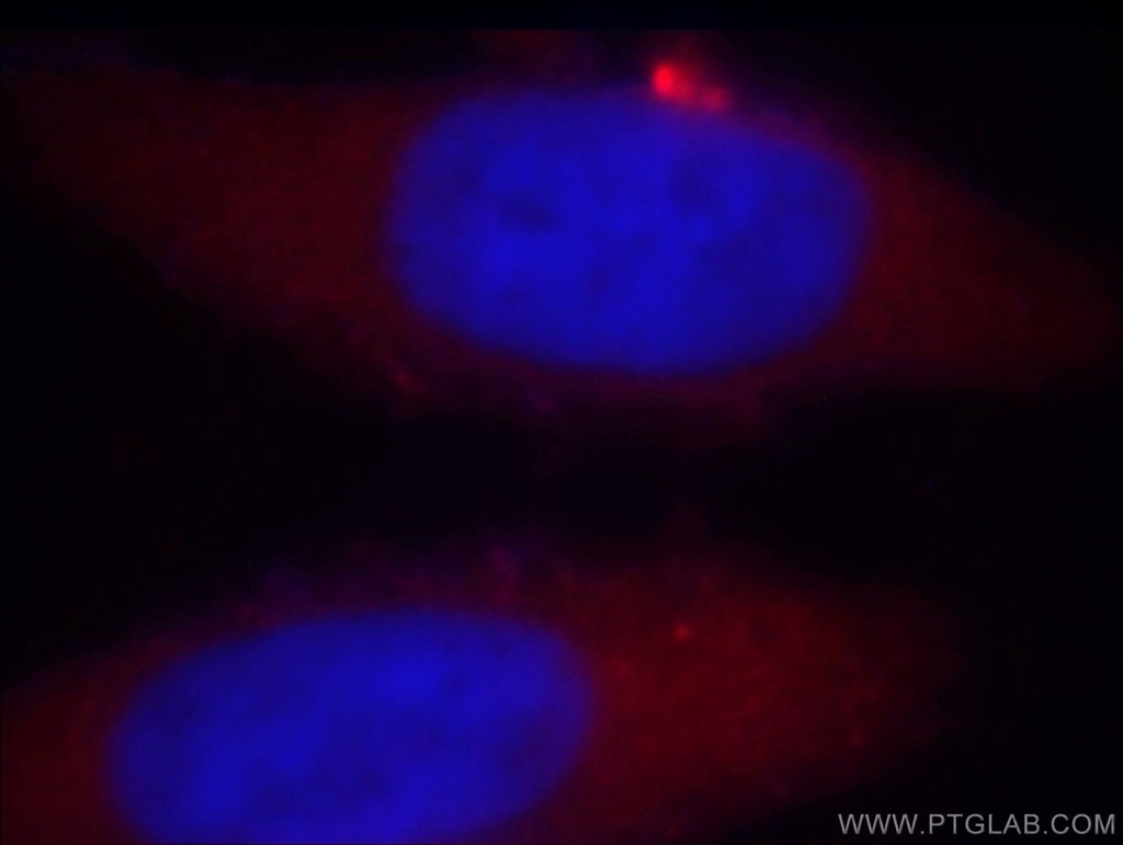 TARS Polyclonal antibody