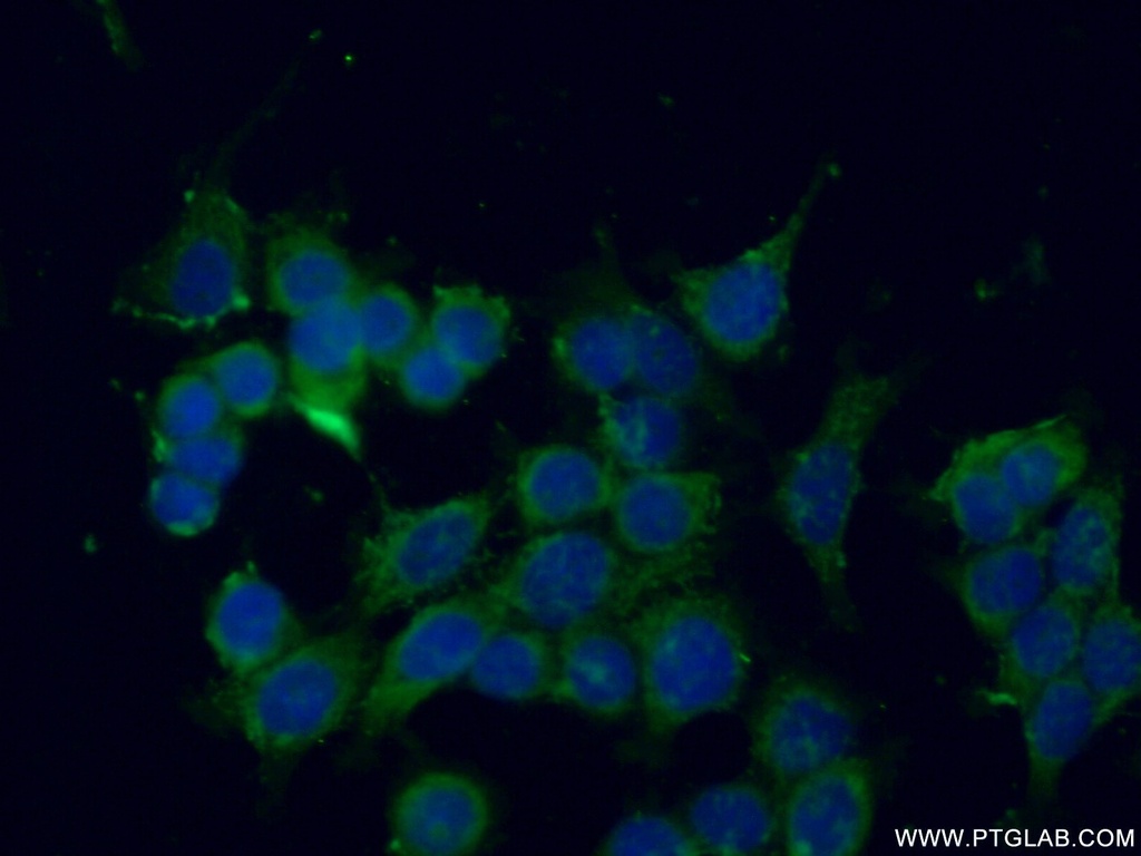 SEC22B Polyclonal antibody