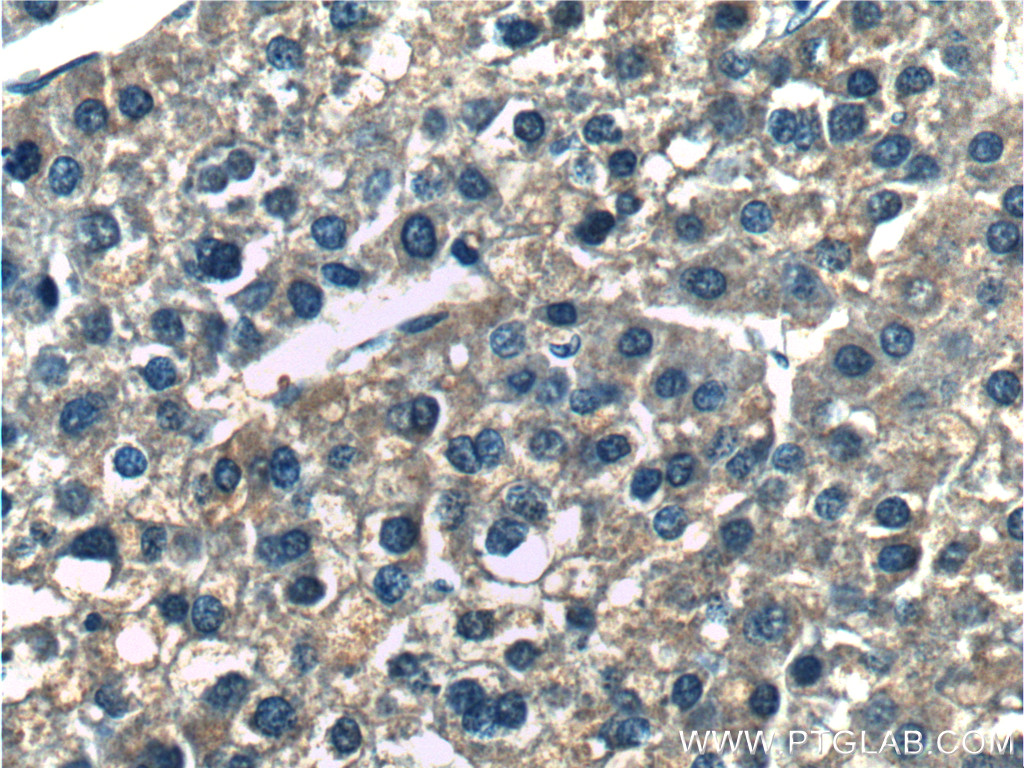 ERLIN2 Polyclonal antibody