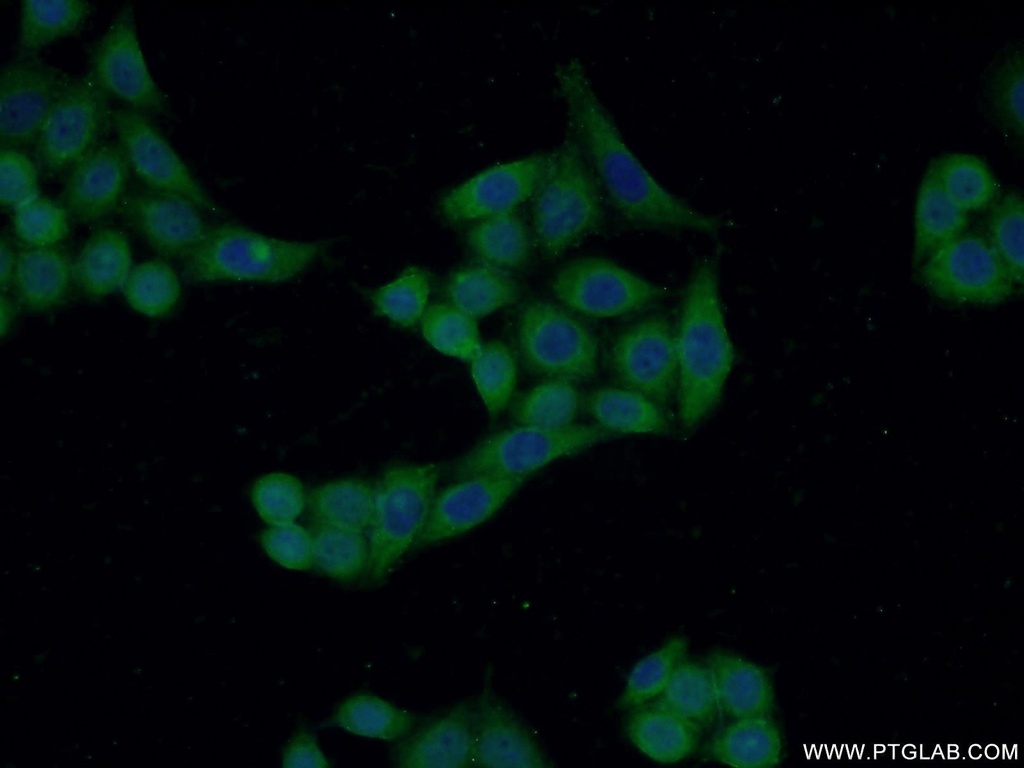 CRIP2 Polyclonal antibody