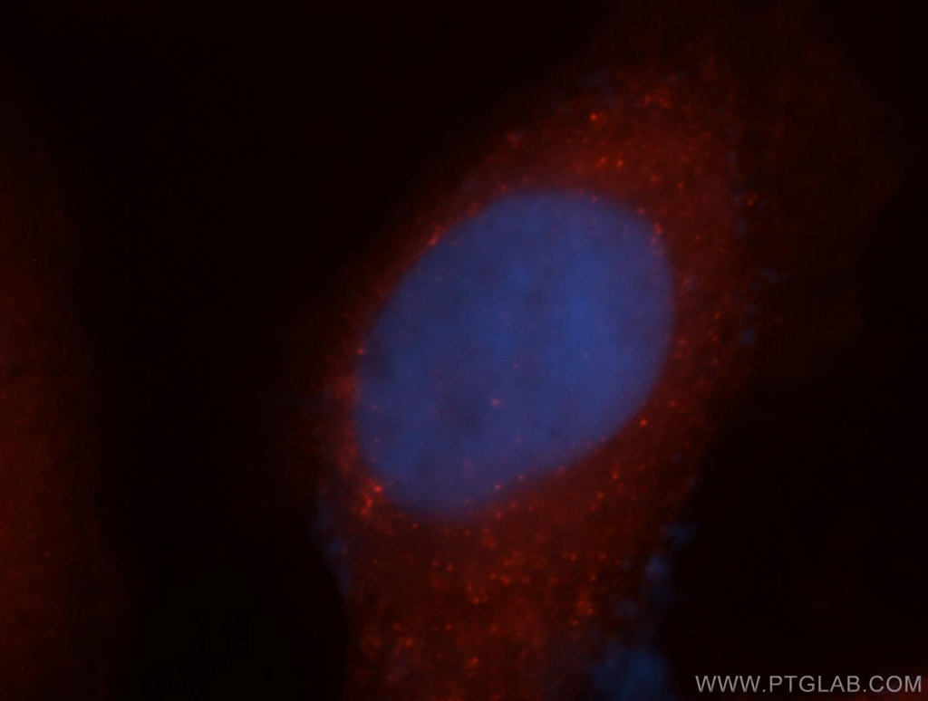 EXOSC2 Polyclonal antibody