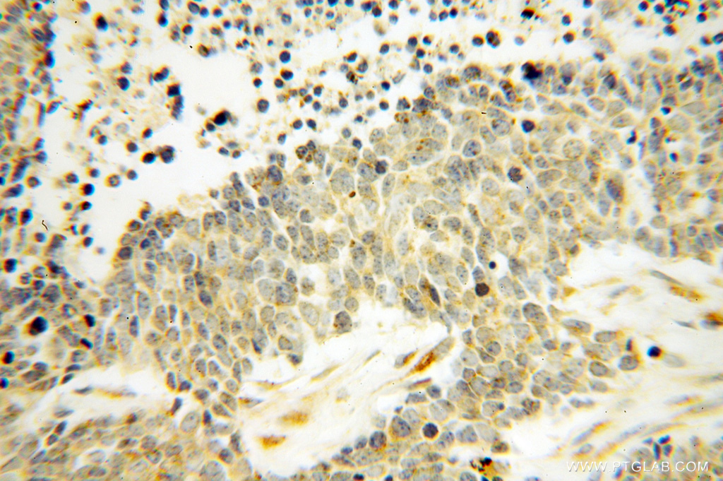 DEXI Polyclonal antibody