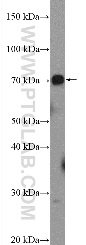 UBOX5 Polyclonal antibody