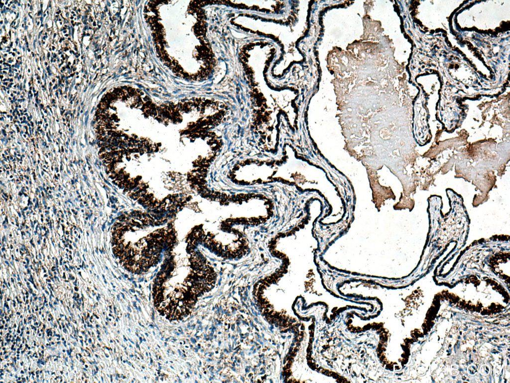 ARG2 Polyclonal antibody