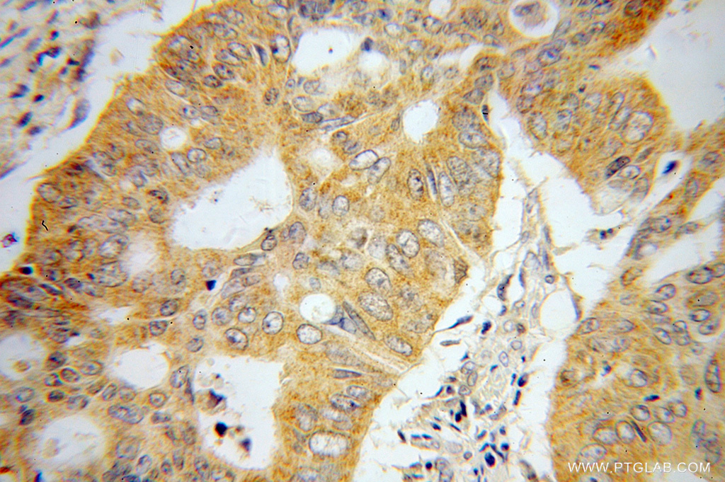 UMPS Polyclonal antibody