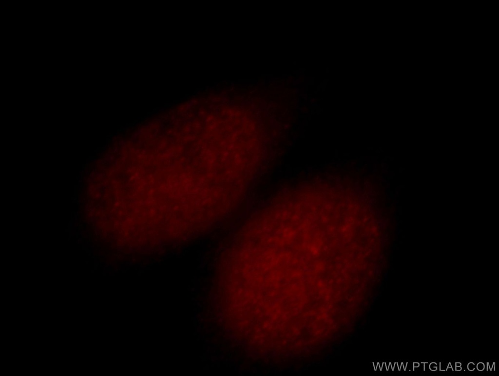 GLYR1 Polyclonal antibody